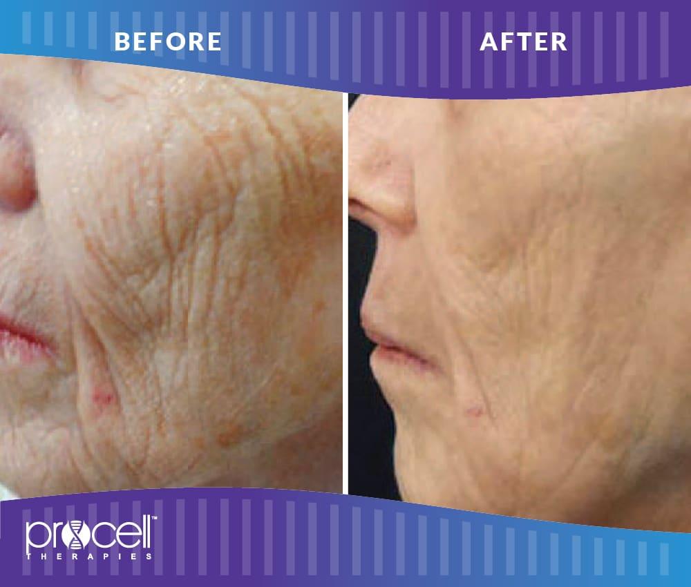 Lysa Marie INK Certified Procell Microchanneling Professional