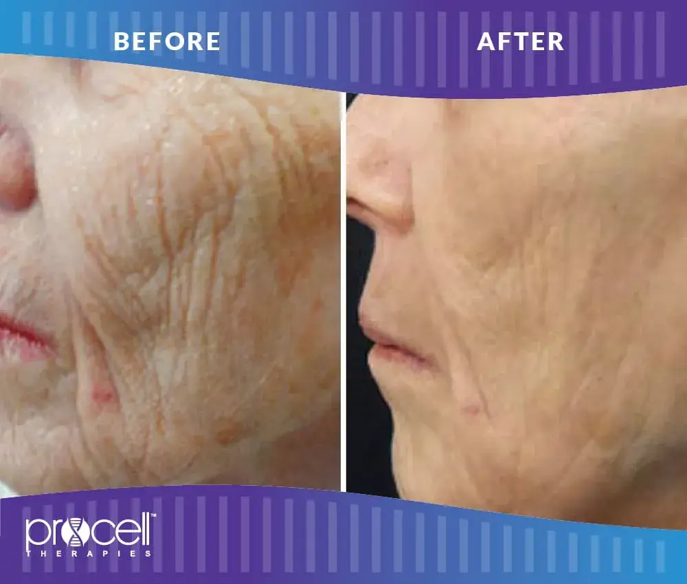 Lysa Marie INK Certified Procell Microchanneling Professional