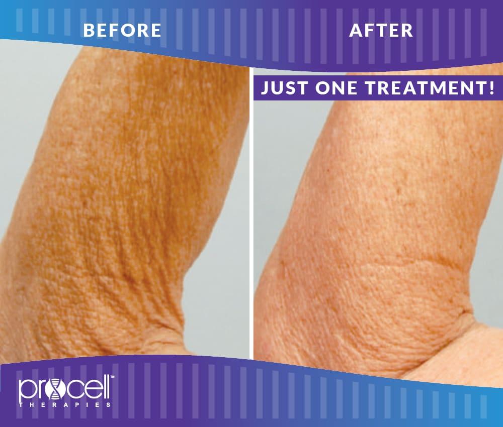 Lysa Marie INK Certified Procell Microchanneling Professional