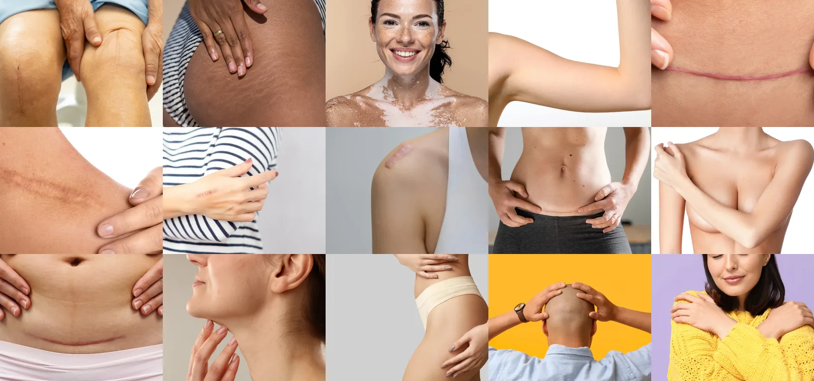 Conceal Your Skin Imperfections